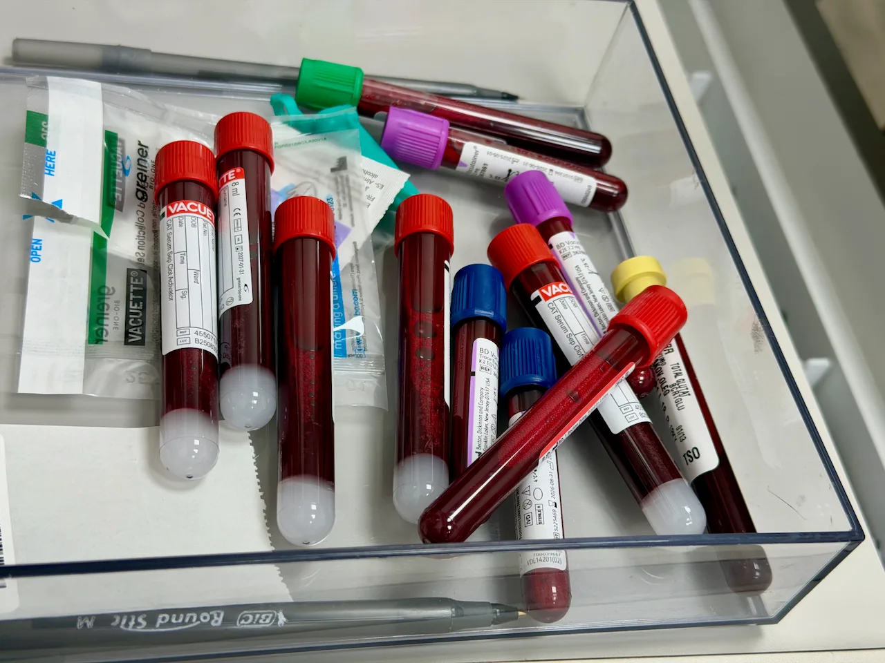 Photo of basic blood test: Compare the price of basic blood test across countries and see how much it weighs against the local average salary