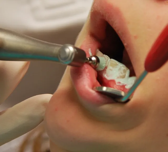 Foto de limpeza dental: Compare o preço de limpeza dental em diferentes países e veja quanto esse custo pesa no salário médio local